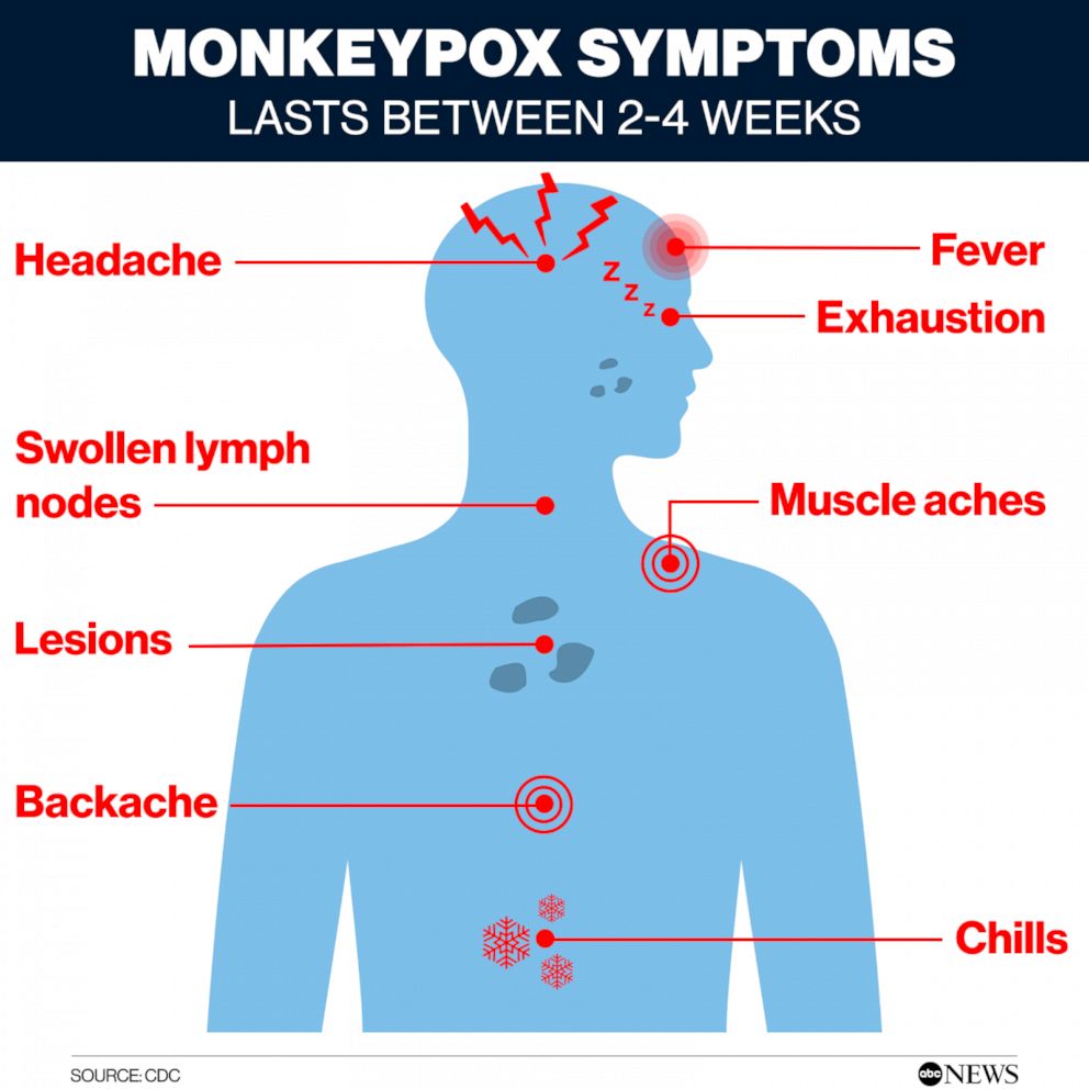 Symptoms from Monkeypox begin to develop about 1-4 days after initial contraction. Rashes are a common symptom reported by patients,  most often appearing first on the face, hands or feet and then spreading to the rest of the body.